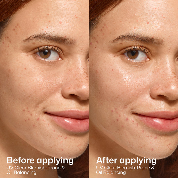 mini uv clear blemish prone oil balancing
