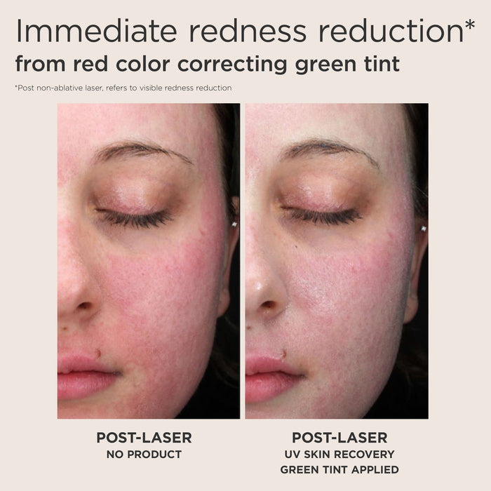 Redness Reduction