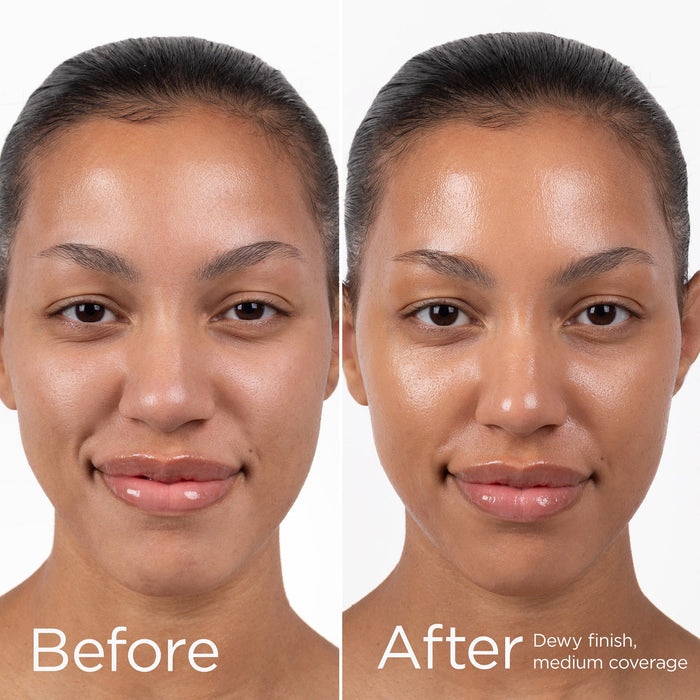 AOX 2 Before & After