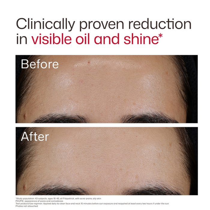 Before and after comparison of oil and shine reduction on skin