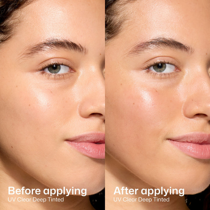 Before and after comparison of UV Clear Deep Tinted product on a person's face.