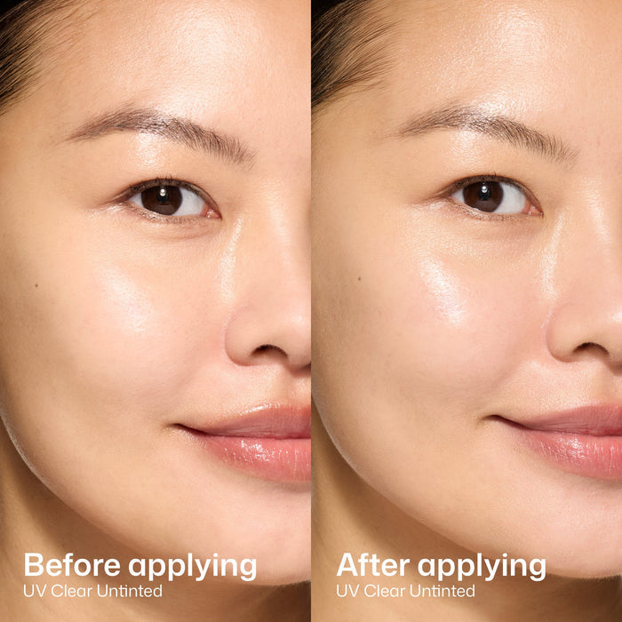 Before and after comparison of UV Clear Untinted product on a person's face.
