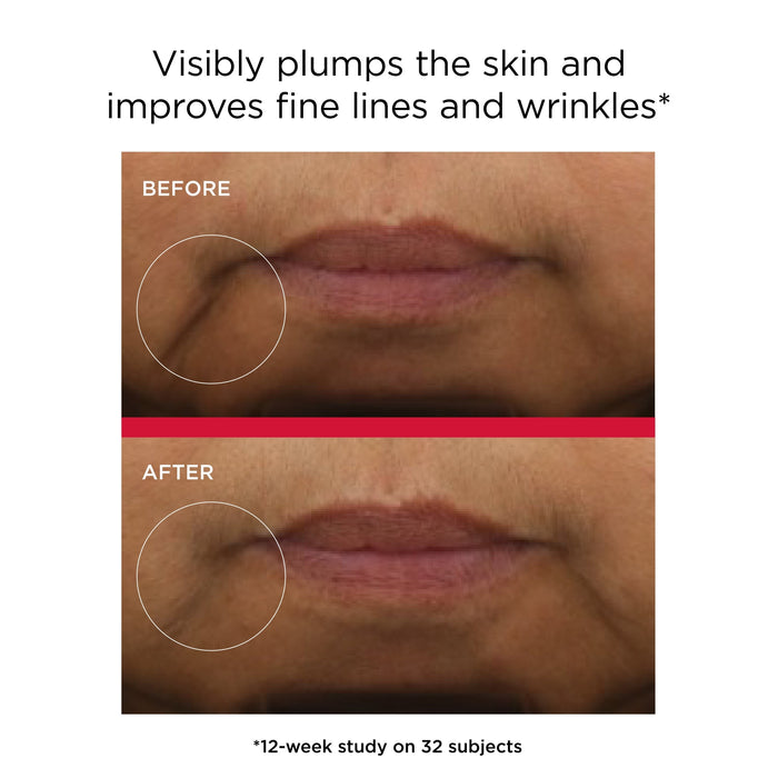 Before and after comparison of skin plumping and wrinkle improvement with text indicating a study on 32 subjects.