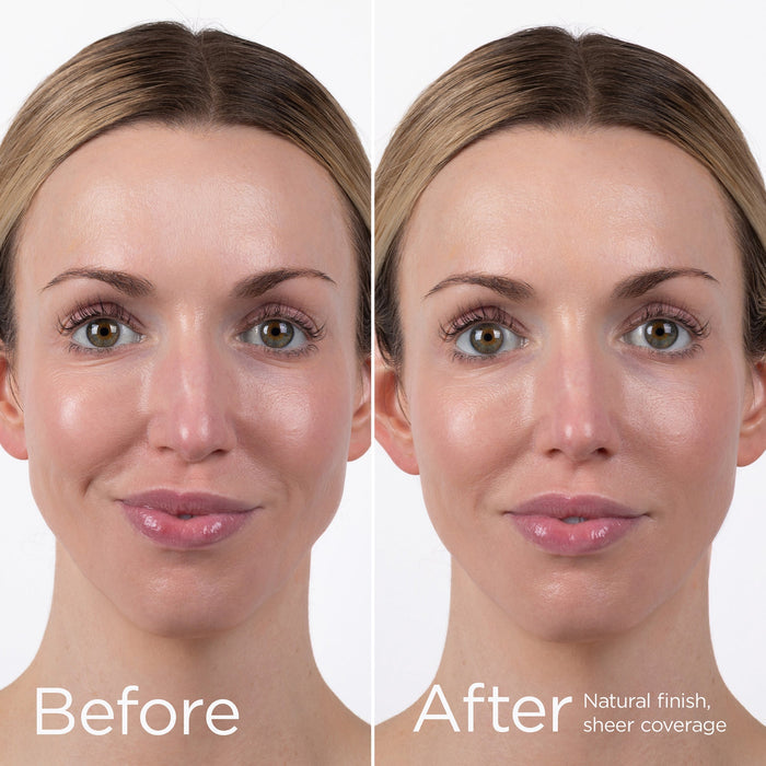 UV Physical Before & After
