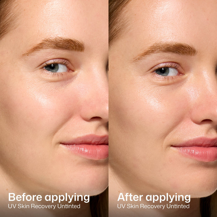 Before and after comparison of UV Skin Recovery Untinted on a person's face.